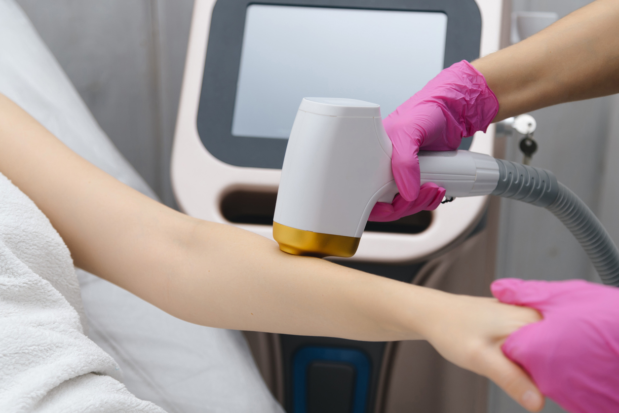 當居家護理無效時，可尋求醫生協助，透過處方藥膏、光學治療或激光脫毛等專業醫療方法來改善嚴重的毛囊角化症。