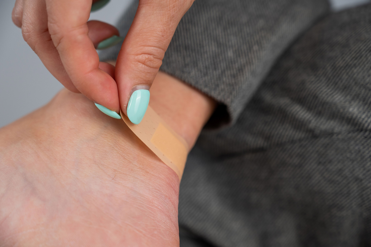 水泡處理的核心原則是保持完整和避免感染,若水泡意外破裂,應溫和清潔、保留水泡皮,並塗抹抗生素藥膏或凡士林後用透氣敷料覆蓋。