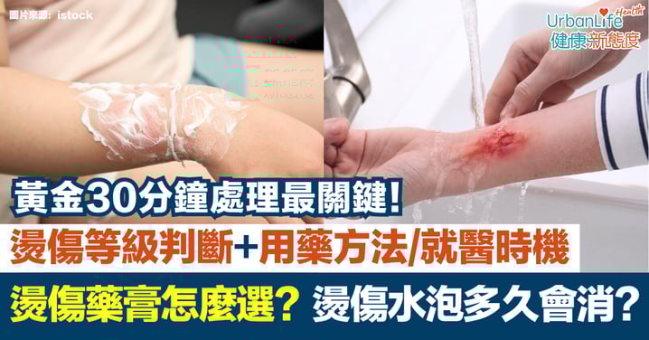 燙傷藥膏怎麼選?燙傷水泡多久會消?黃金30分鐘處理+燙傷等級判斷+用藥方法/就醫時機懶人包