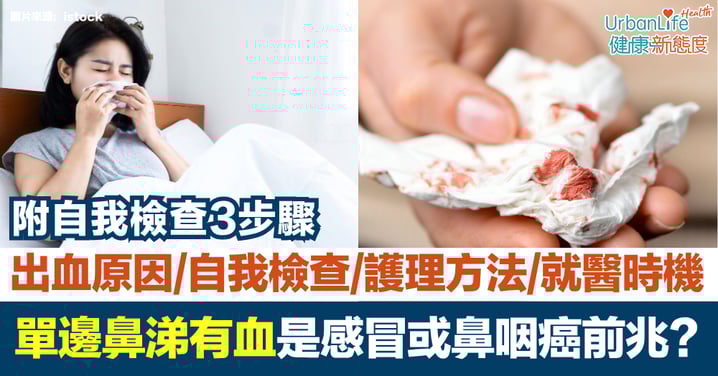 單邊鼻涕有血!是感冒還是鼻咽癌前兆?出血原因+自我檢查+護理方法+就醫時機一覽