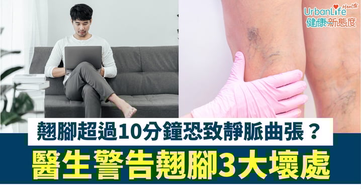 【坐姿警號】翹腳超過10分鐘恐致靜脈曲張?醫生警告3大壞處:不止傷脊椎、更可致血栓!