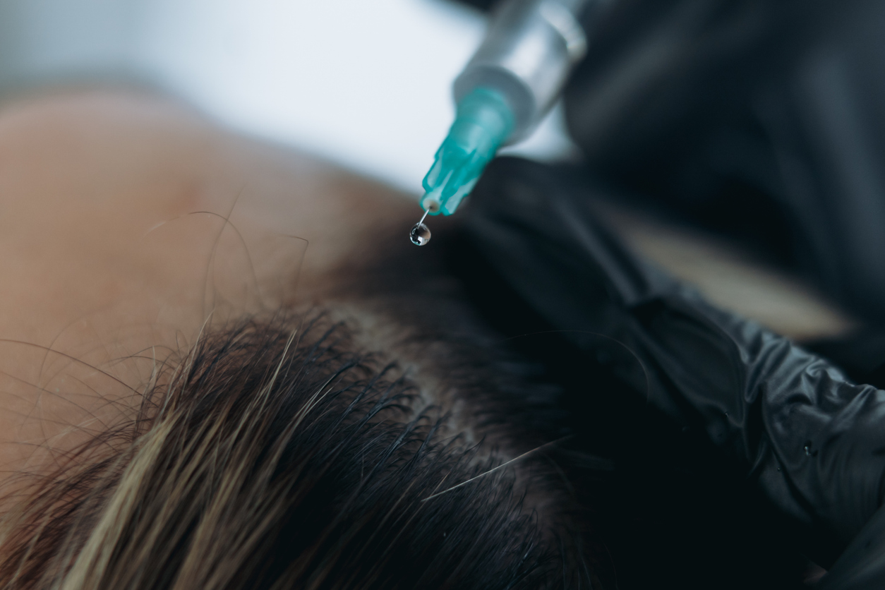 外泌體注射的頻率需由醫生根據個人膚質、年齡與需求決定，初期通常建議每 2 至 4 週密集施打 2 至 3 次啟動修復，之後則調整為每 3 至 6 個月維持一次，而生髮療程則建議約每 4 至 6 週 1 次完成完整療程。