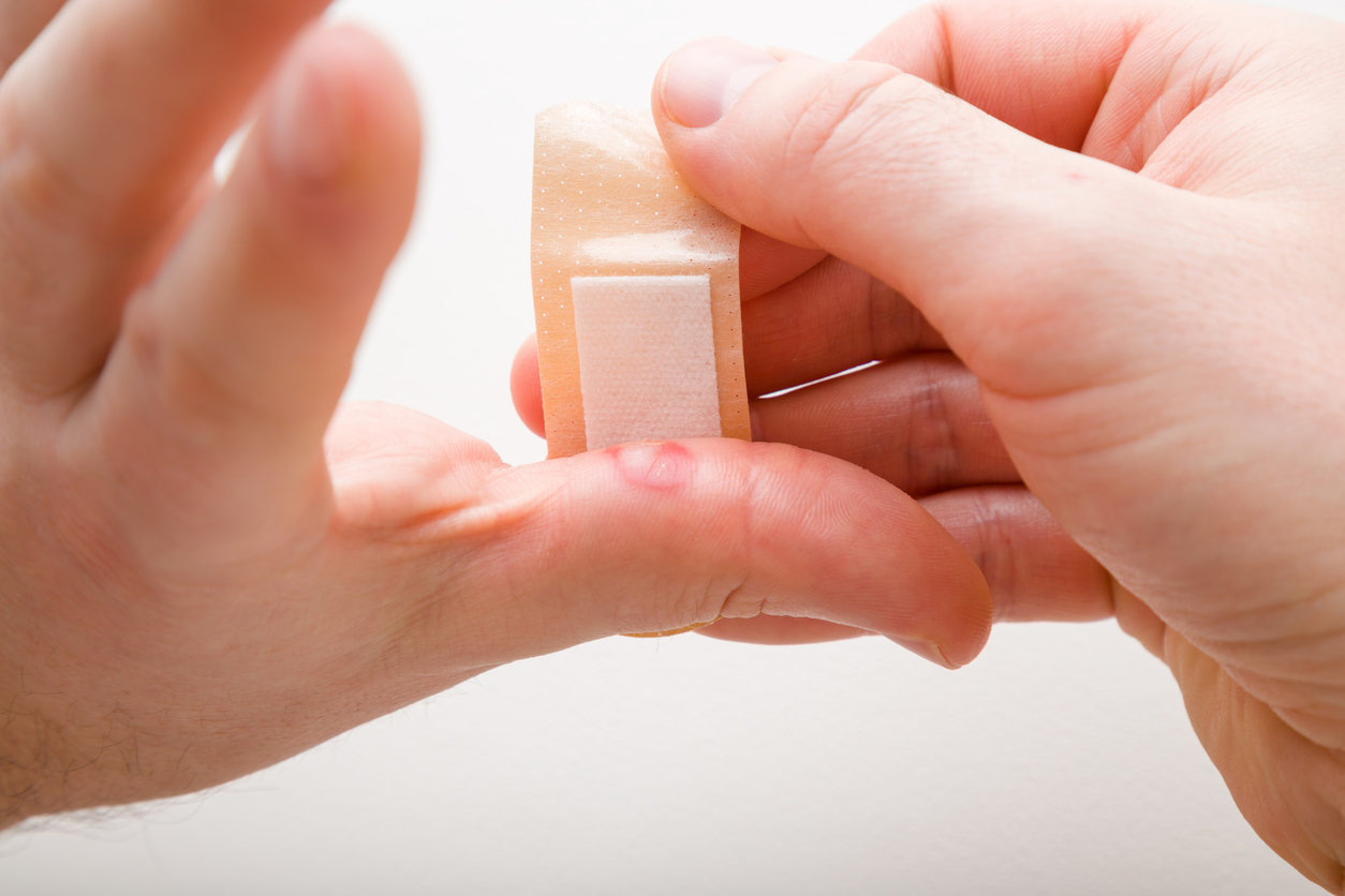 燙傷後續護理的關鍵是保持傷口清潔和濕潤（用溫水/生理食鹽水，塗抹保濕藥膏），同時嚴格防曬和防摩擦、避免摳皮撕痂，並透過均衡飲食和補水來幫助皮膚修復，以減少疤痕和色素沉澱。