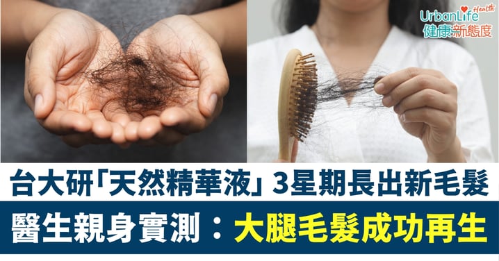 【禿頭救星】台大研發「天然精華液」 3星期令無毛老鼠長出毛髮!醫生親身實測:大腿毛髮成功再生