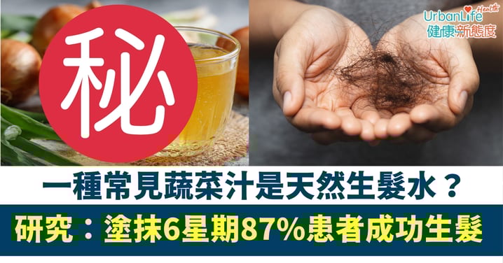 【脫髮救星】洋蔥汁變天然生髮水？研究：塗抹6星期 87%患者成功生髮、男士效果更顯著