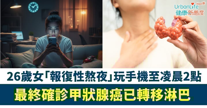 【癌症年輕化】打工仔每晚「報復性熬夜」玩手機至凌晨2點 26歲女確診甲狀腺癌已轉移淋巴 醫生:熬夜是癌變加速器