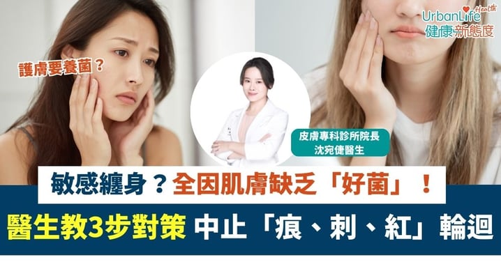 【抗敏斷尾】天氣反覆,敏感纏身?全因肌膚缺乏「好菌」!皮膚科醫生教3步對策 中止「痕、 刺、紅」輪迴