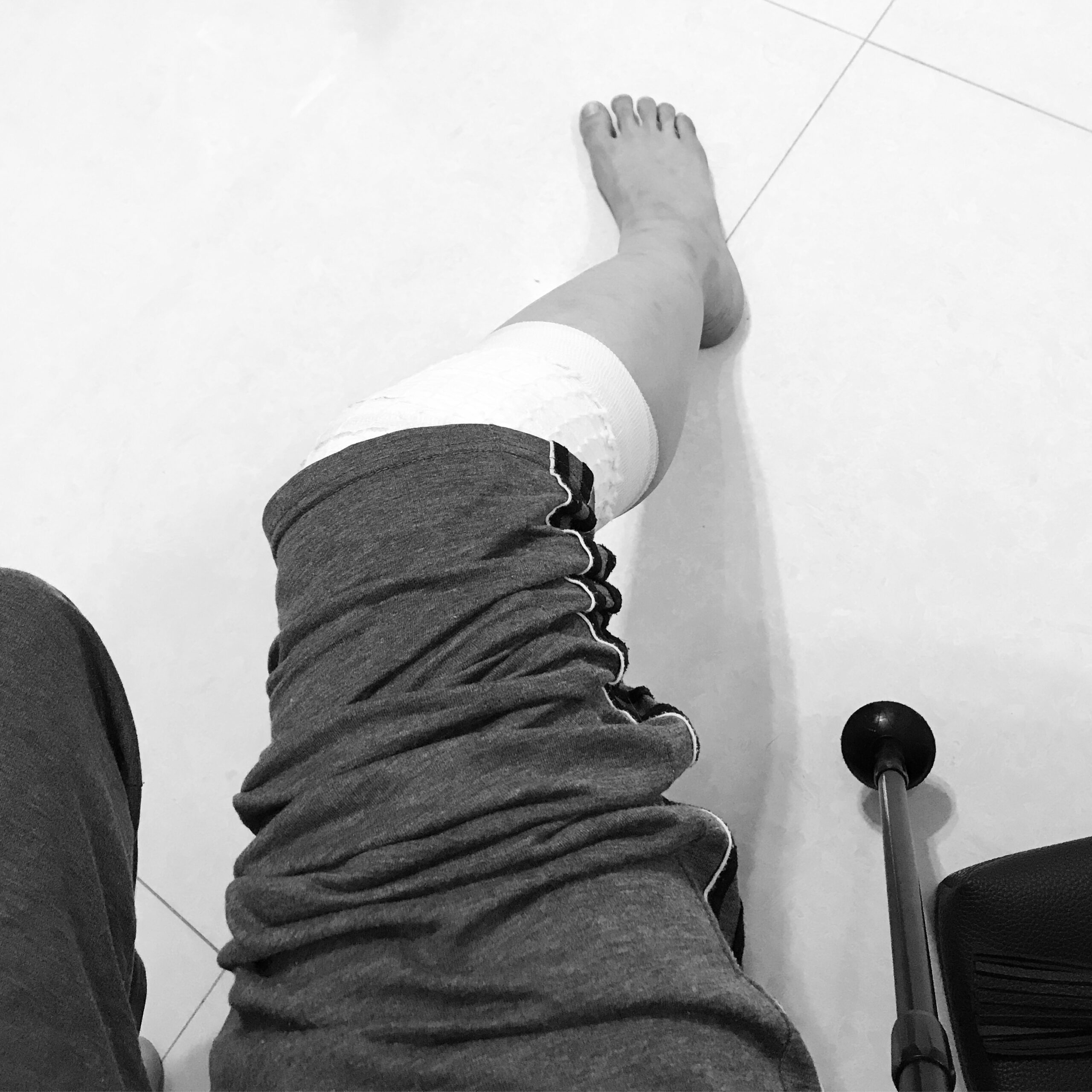 那次受傷導致她前十字韌帶（ACL）撕裂，復康期長達9個月。