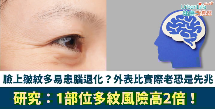 【健康警號】臉上皺紋多易患腦退化？研究：1部位多紋風險高2倍！外表比實際老恐是先兆
