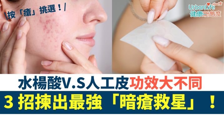 【暗瘡貼推薦】點解貼極都冇用？暗瘡貼功效、種類及挑選技巧全攻略