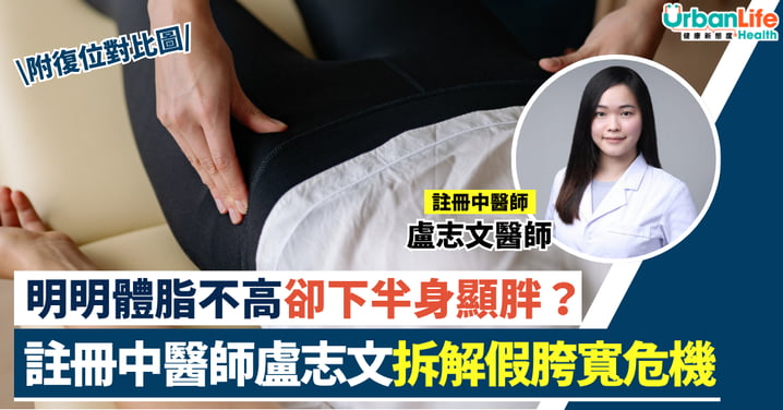【中醫正骨】明明很瘦卻下半身顯胖？註冊中醫師盧志文醫師拆解「假胯寬」危機（附復位對比圖）