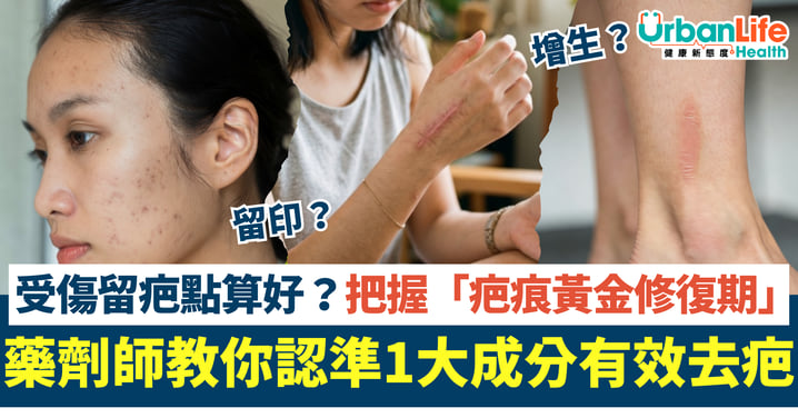 受傷留疤點算好？把握疤痕 「黃金修復期」 藥劑師教你認準1大成分有效去疤