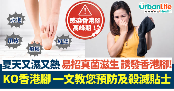 【KO香港腳】夏天又濕又熱,易招真菌滋生,誘發香港腳! 一文教您預防及殺滅貼士