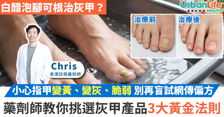 小心指甲變黃、變灰、脆弱 別再盲試網傳偏方 藥劑師教你挑選灰甲產品3大黃金法則