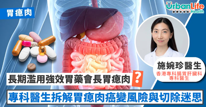 【安全用藥】長期濫用強效胃藥會長胃瘜肉?專科醫生拆解胃瘜肉癌變風險與切除迷思