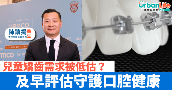 兒童矯齒需求被低估?及早評估守護口腔健康