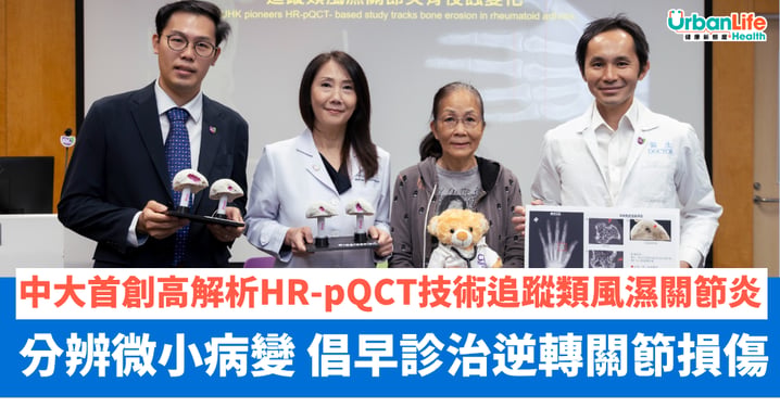 【中大醫學院】首創高解析HR-pQCT技術追蹤類風濕關節炎骨侵蝕變化 準確分辨微小真正病變 倡早診早治逆轉關節損傷