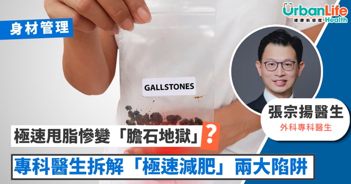 【身材管理】極速甩脂慘變「膽石地獄」!醫生拆解「極速減肥」兩大陷阱 揭3大「不傷膽」瘦身原則