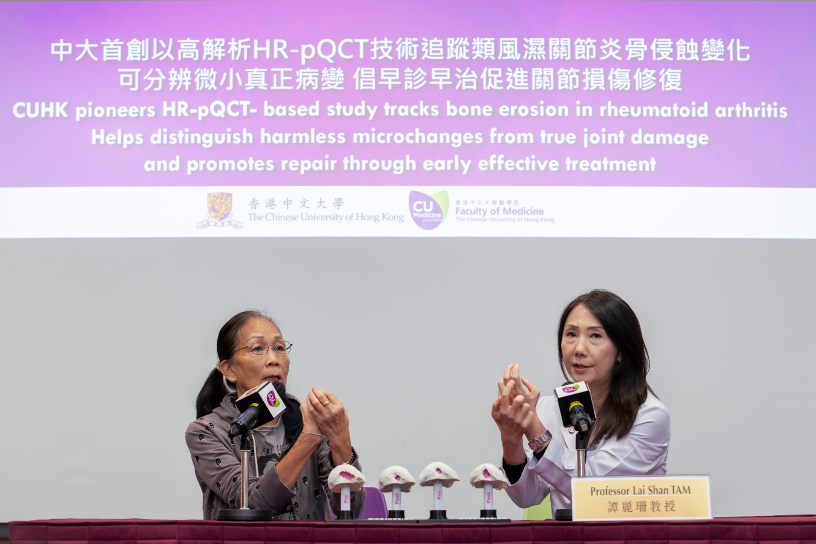 年逾七旬的劉女士(左)早於10年前出現中指、食指關節腫痛及晨僵症狀,求診家庭醫生後數月獲轉介風濕科,確診患有類風濕關節炎並接受達標治療,服藥後半年炎症已受控,現時手指關節活動與同齡人士無別。