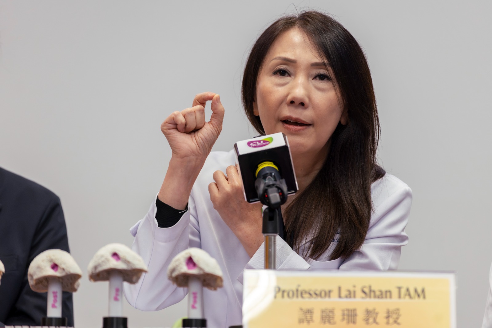 譚麗珊教授表示,團隊正研究應用HR-pQCT技術於早期類風濕關節炎檢測,並收集更多臨床數據,以期可將有關技術普及成類風濕關節炎的常規診斷工具。